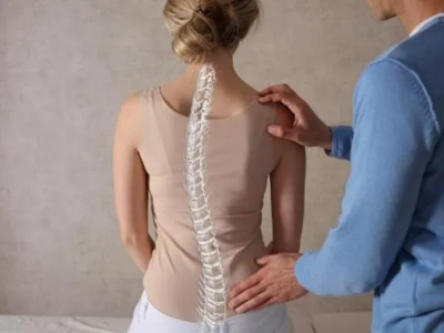 Managing Scoliosis with Physiotherapy